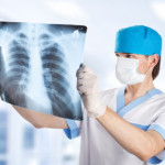 Рентген при ГВ: что необходимо знать маме