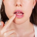 Герпес при грудном вскармливании: чем лечить и можно ли кормить грудью